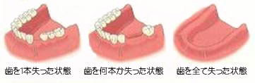 （1）診査と治療計画