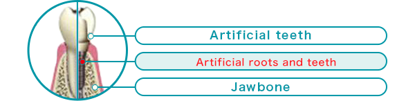 Artificial roots and teeth